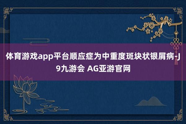 体育游戏app平台顺应症为中重度斑块状银屑病-J9九游会 AG亚游官网